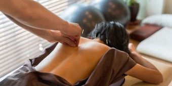 acupuncture